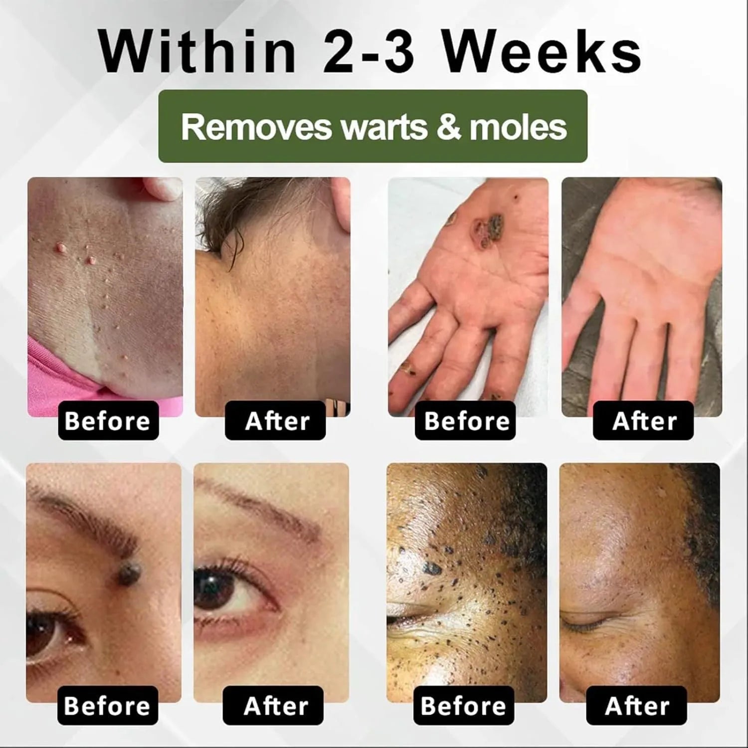 Natureerase Instant Mole Spot Removal Gel 45g hydrating skincare product