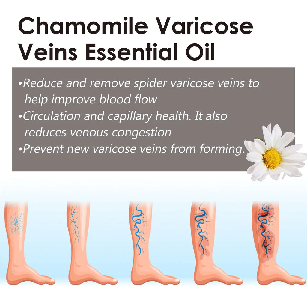 10ml bottle of chamomile essential oil for leg skin care and massage