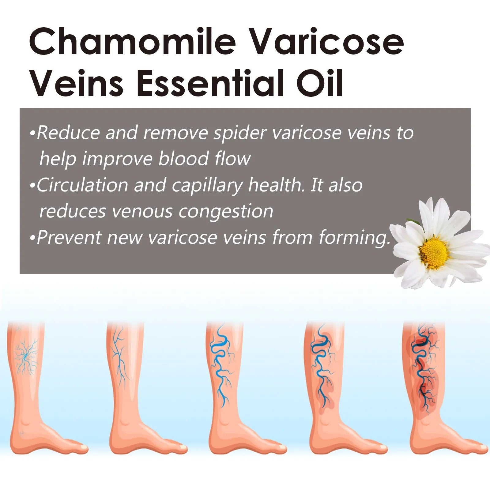 10ml bottle of chamomile essential oil for leg skin care and massage
