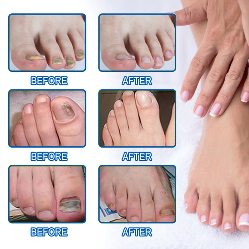 Box of 32 nail repair adhesive bandage patches, each measuring 6.1 by 3.5 centimetres.