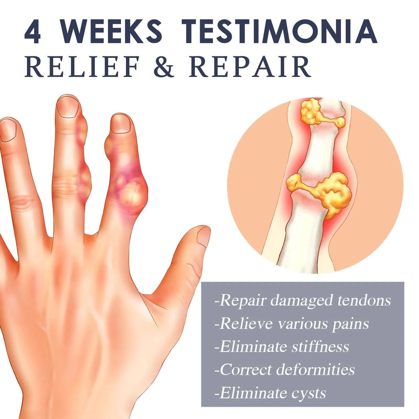 A 20g tube of joint pain massage cream for topical application.