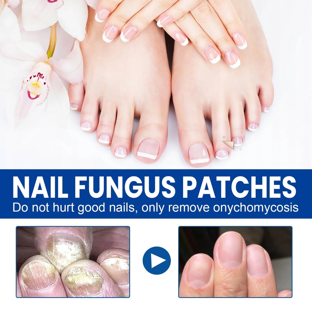 Box of 32 nail repair adhesive bandage patches, each measuring 6.1 by 3.5 centimetres.
