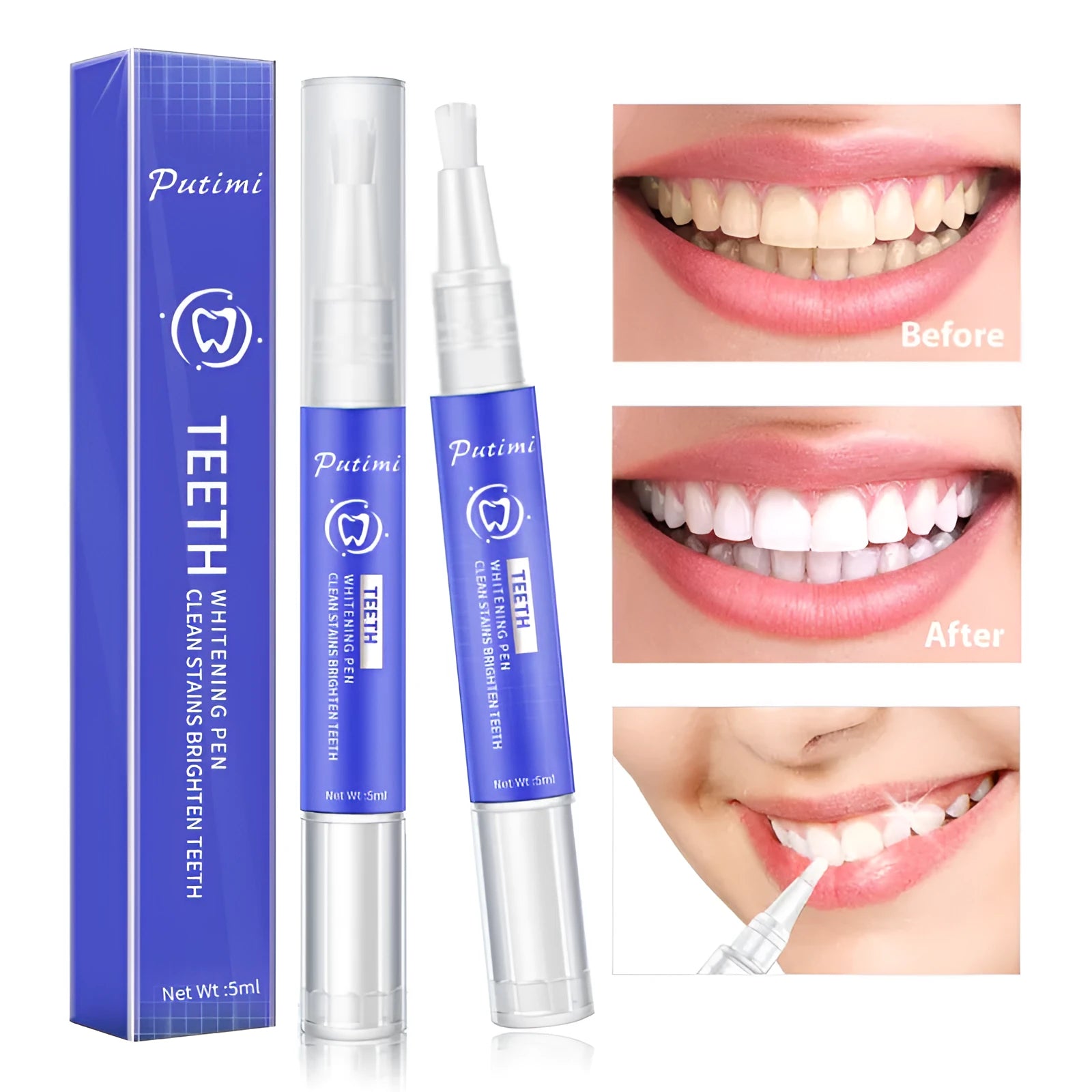 White teeth whitening pen with applicator tip on blue background