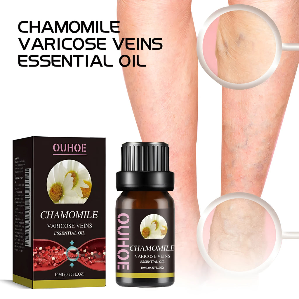 10ml bottle of chamomile essential oil for leg skin care and massage