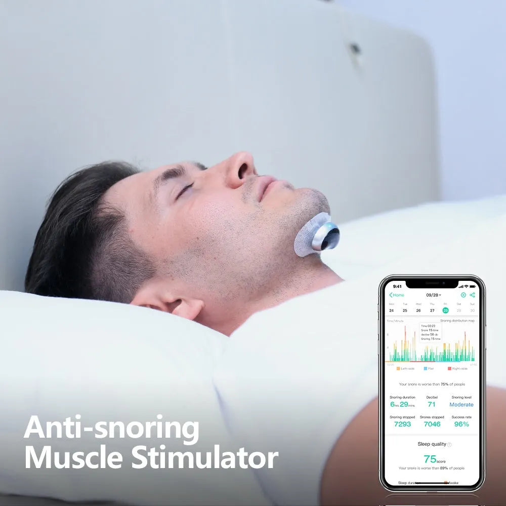 Smart anti-snoring device with electronic muscle stimulator and twenty conductive strips