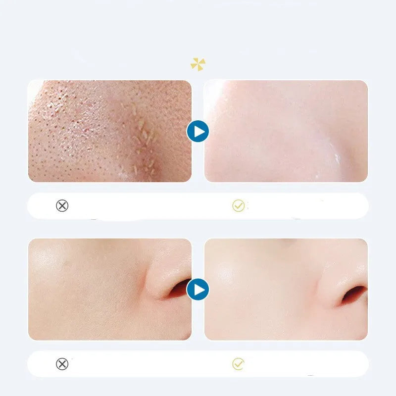 Oligopeptide Small Bubble Cleaning Essence 1.5ml sachet box of 10 for facial cleansing with oligopeptide-1