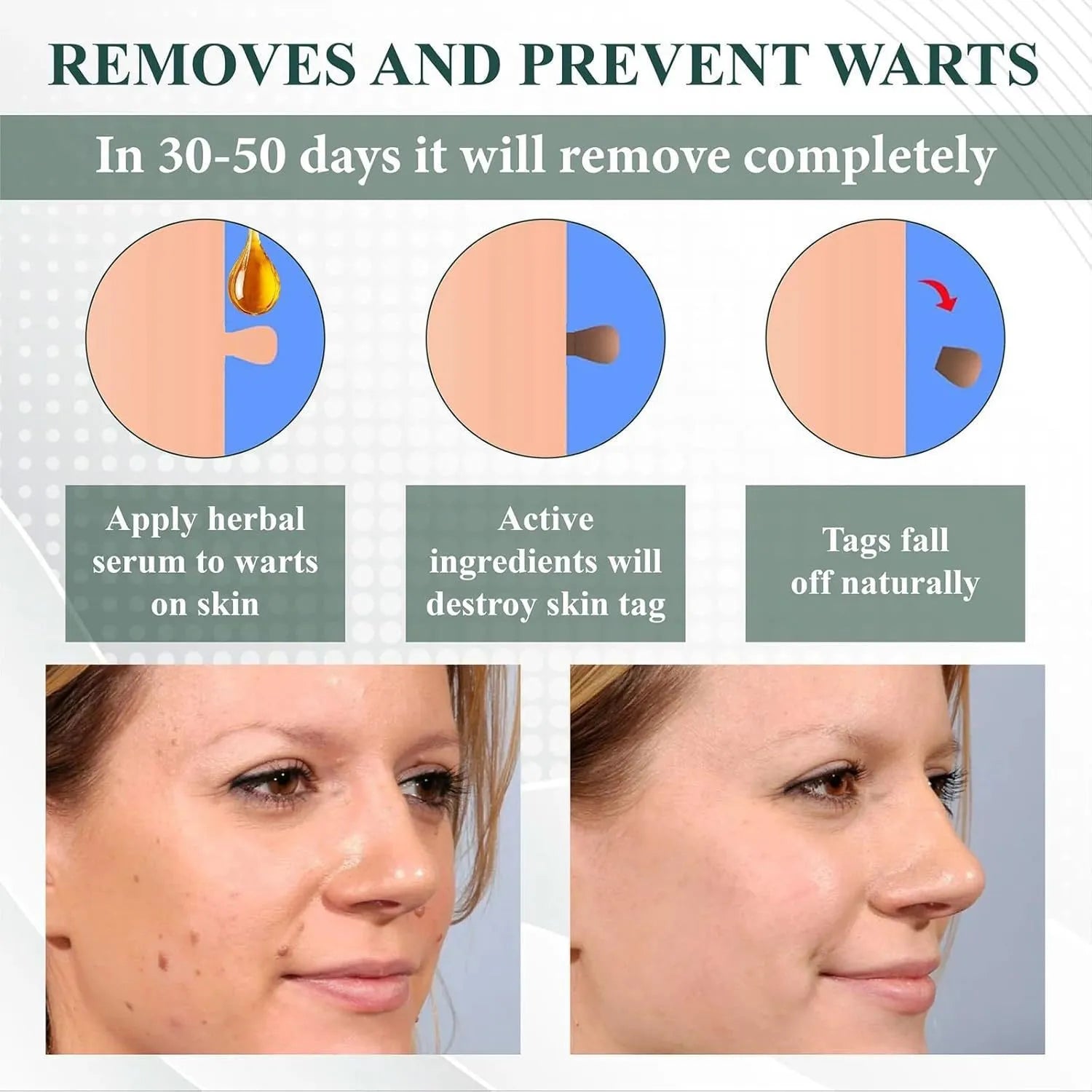 Natureerase Instant Mole Spot Removal Gel 45g hydrating skincare product
