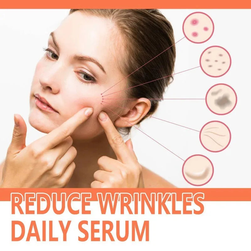 30ml rose essential oil bottle for wrinkles and skin brightening