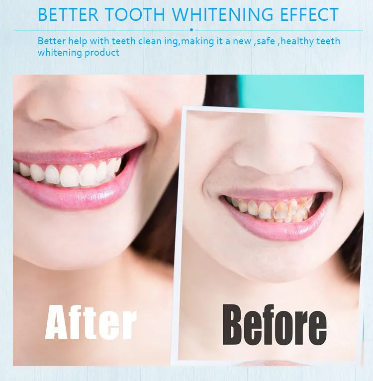 Teeth whitening pen with toothbrush cleaner in gold aluminium case and plastic white options