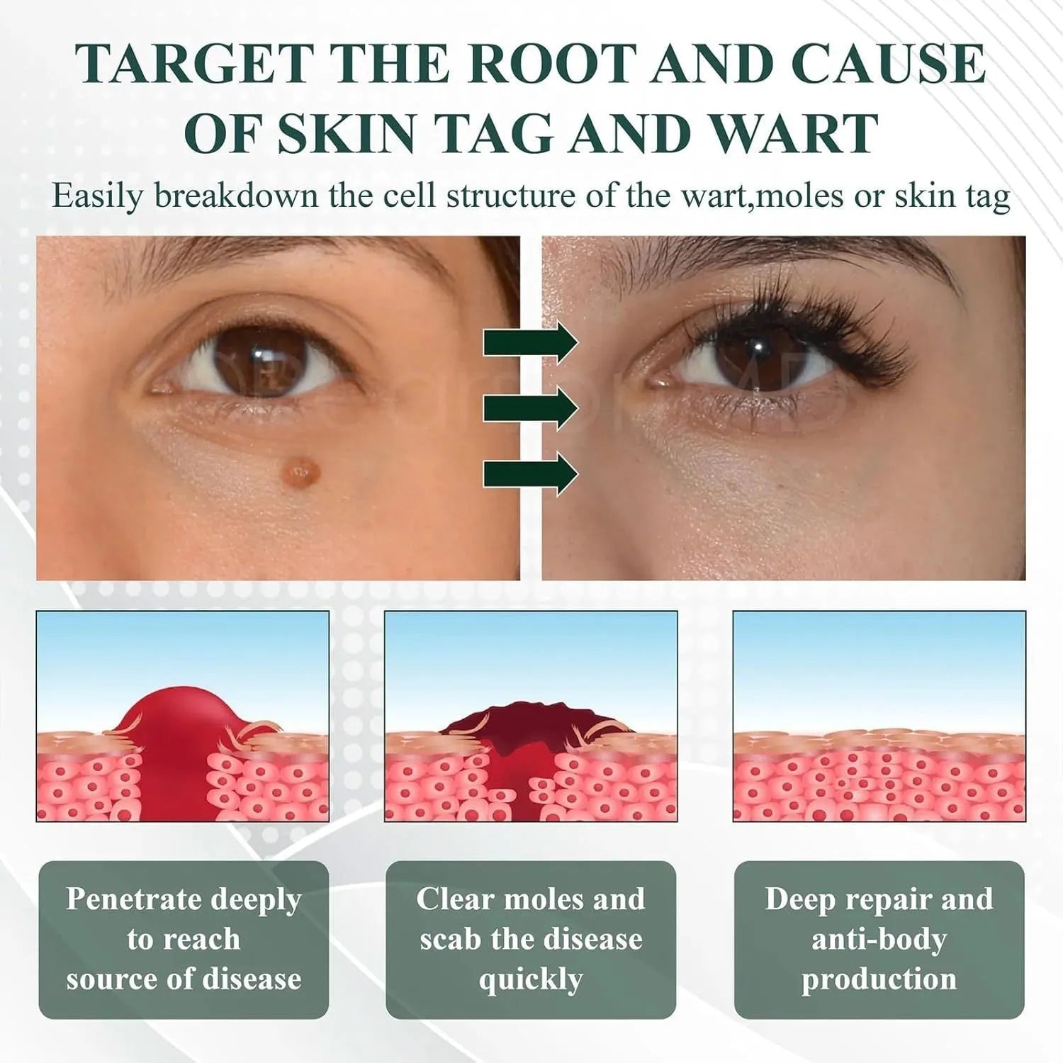Natureerase Instant Mole Spot Removal Gel 45g hydrating skincare product