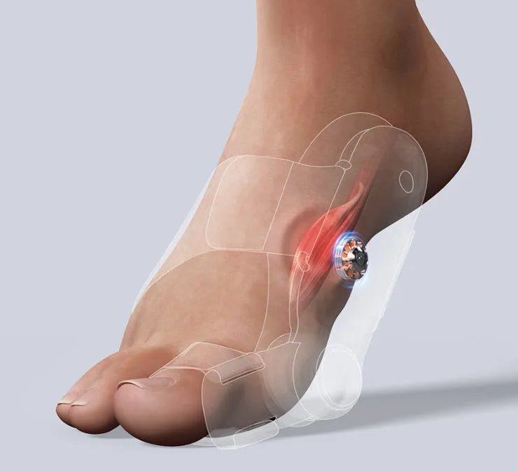 White plastic electric hallux valgus toe separator with Type-C charging cable